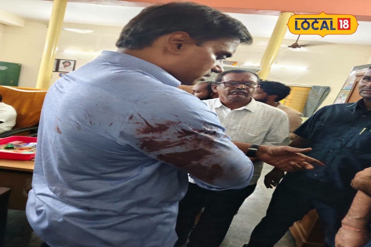 MP Midhun Reddy: టెన్షన్ టెన్షన్..   ఎంపీ మిథున్ రెడ్డికి గాయాలు, ఫోటోలు!