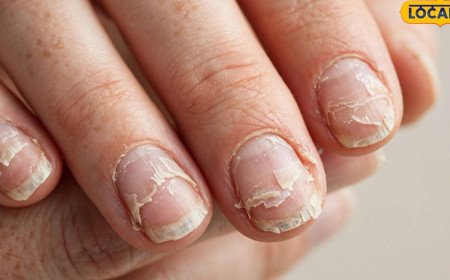 Health Tips: మీ గోళ్లు తరచూ విరిగిపోతున్నాయా.. శరీరంలో ఈ లోపం ఉండొచ్చు జాగ్రత్త..!