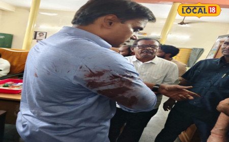 MP Midhun Reddy: టెన్షన్ టెన్షన్..   ఎంపీ మిథున్ రెడ్డికి గాయాలు, ఫోటోలు!