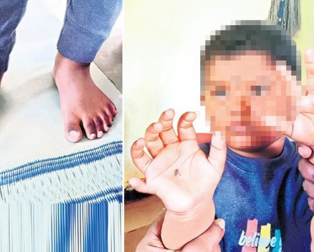 Viral: కళ్లు చెదిరే వింత.. ఈ పిల్లాడికి ఏకంగా 24 వేళ్లు!